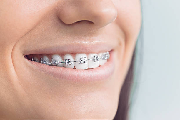 Best Wisdom Tooth Removal  in Payson, AZ